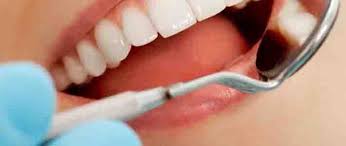 juicio a un dentista acusado de daños a una paciente con implantes