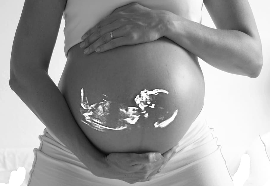 La COVID-19 no tiene consecuencias graves sobre la salud de las embarazadas, aunque sí podría provocar complicaciones en algunos bebés