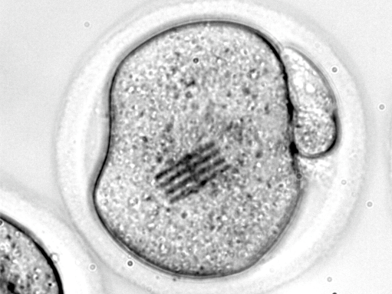 Científicos españoles fabrican chips que son inyectados en óvulos para medir las primeras fases del desarrollo embrionario