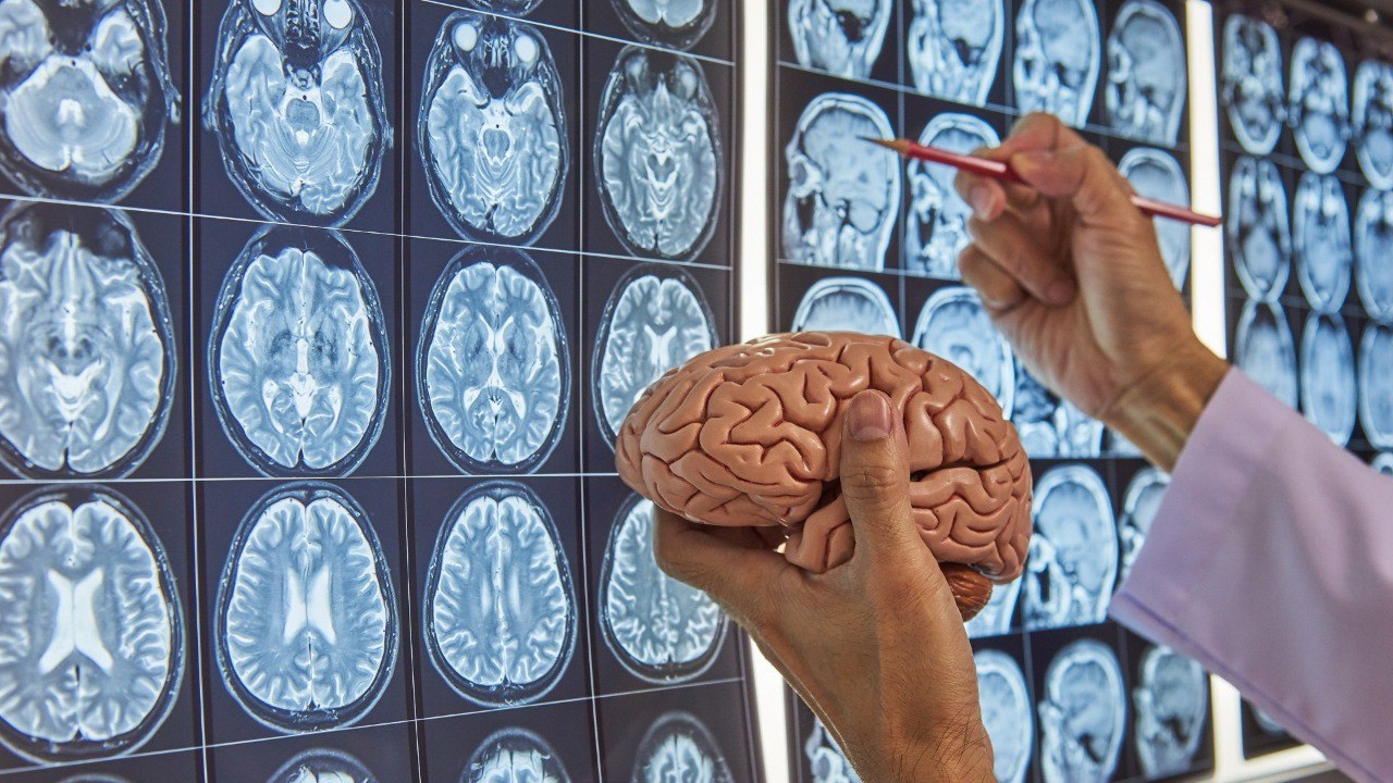 Una aplicación diseñada en la UGR ayuda al estudio del cerebro gracias a la inteligencia artificial